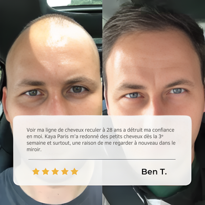 Sérum Roll-on Activateur de Croissance