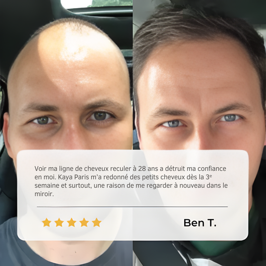 Sérum Roll-on Activateur de Croissance