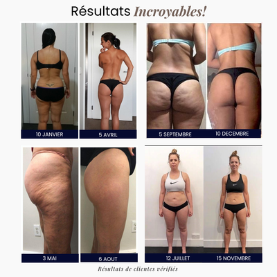 Legging 3D Anti-Cellulite