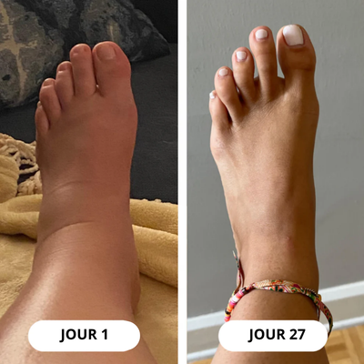 Gouttes de bien-être pour le drainage lymphatique