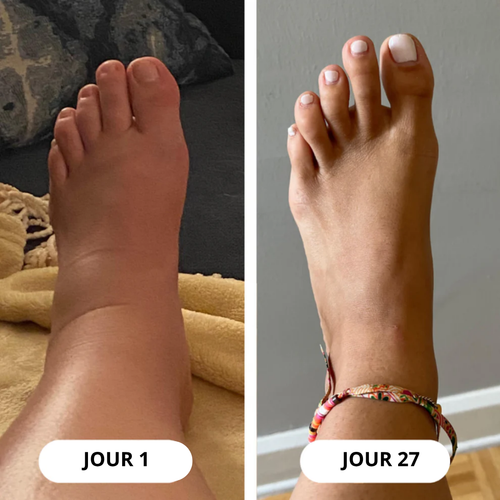 Gouttes de bien-être pour le drainage lymphatique