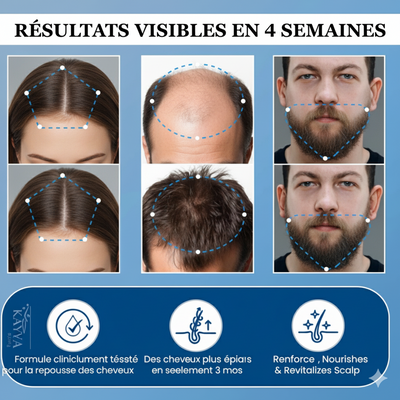 Sérum Roll-on Activateur de Croissance