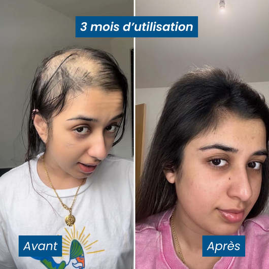 Sérum Roll-on Activateur de Croissance