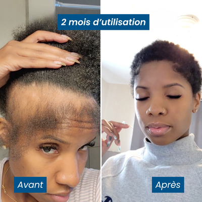 Sérum Roll-on Activateur de Croissance