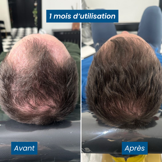 Sérum Roll-on Activateur de Croissance